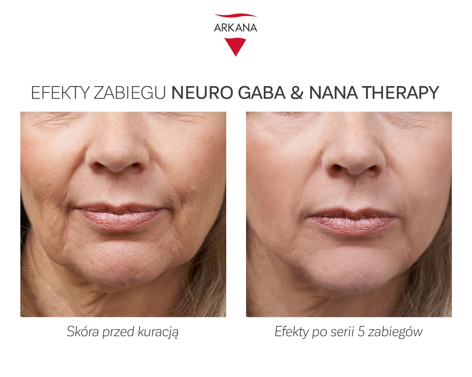 Zabieg silnie liftingujący Neuro nana&gaba therapy Dotyk piękna